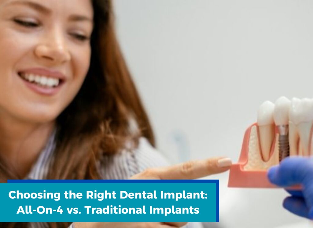 All-On-4 Implants in ludhiana, Traditional Implants in ludhiana, Dental procedure in ludhiana, Dental implants in ludhiana.