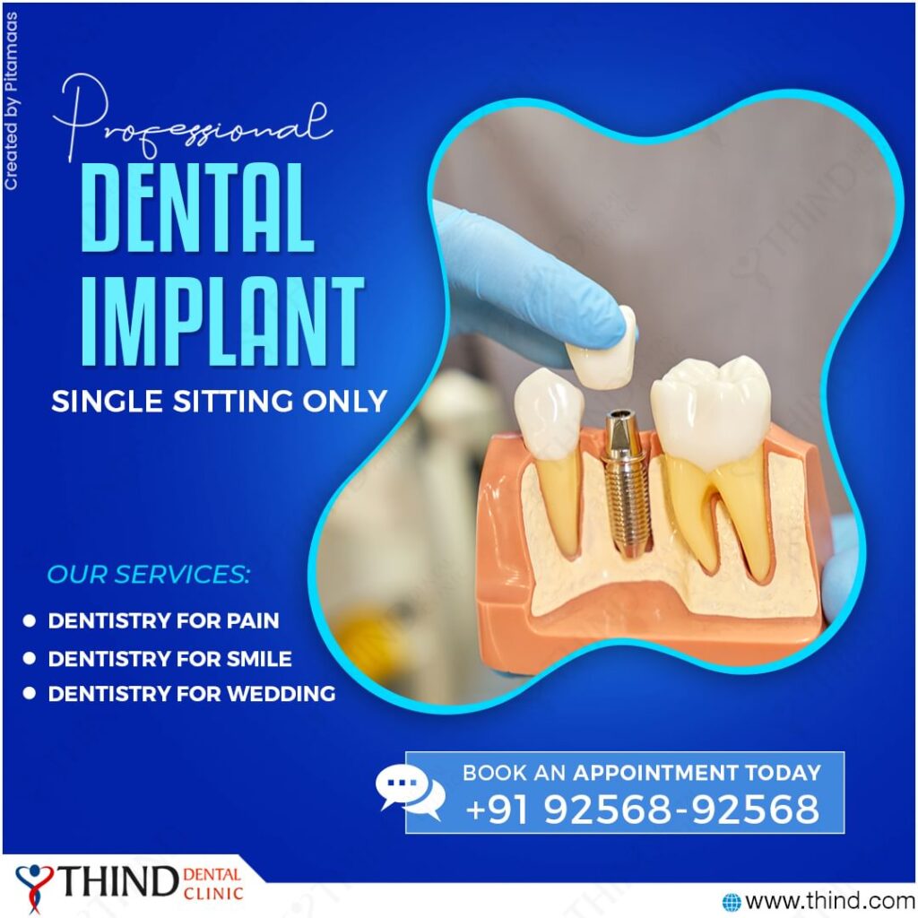 Professional Dental Implants Restoring Smiles With Precision And Care At Thind Dental Clinic In