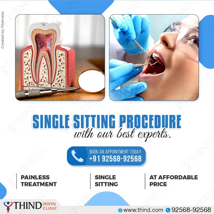 Single Sitting Procedure at Thind Dental Clinic, Painless and Affordable Dental Care at Thind Dental Clinic, dentist in ludhiana, dental clinic in ludhiana