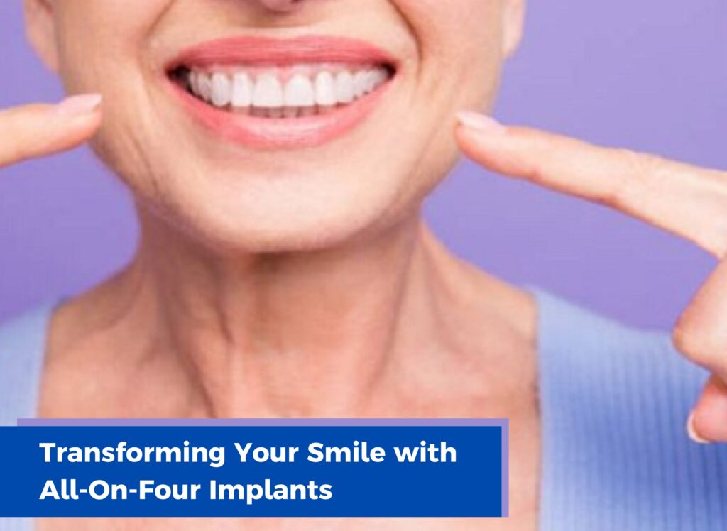 Smile dentistry, Transforming Your Smile, All-On-Four Implants, dental implants in ludhiana, dentist in ludhiana