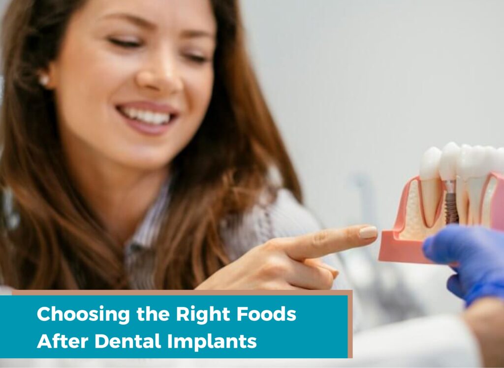 Choosing the Right Foods After Dental Implants, what food are good for eating after dental implants, dental procedure in ludhiana, is it okay to eat acidic food after dental procedure, Foods to avoid after dental implant surgery