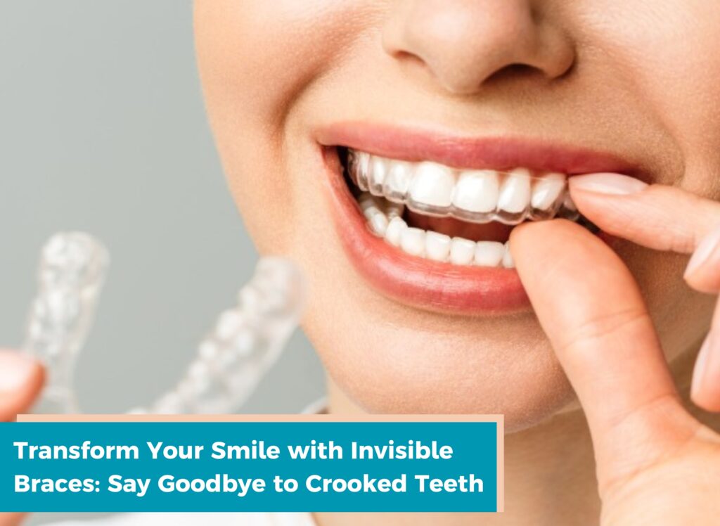 invisible braces, crooked teeth treatment in ludhiana, invisible braces cost, dental clinic in ludhiana