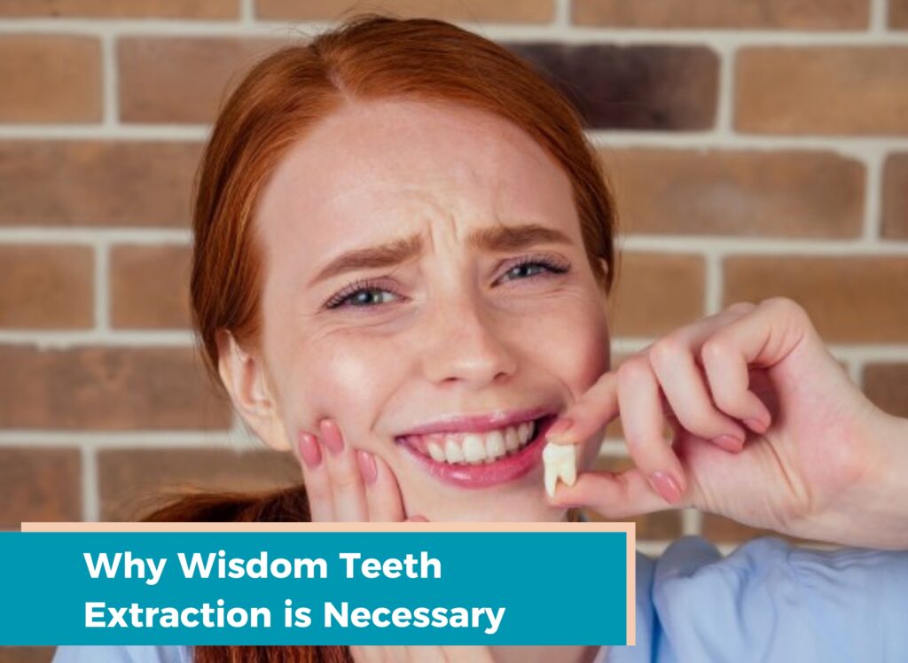 Why Wisdom Teeth Extraction is Necessary, Wisdom tooth extraction in ludhiana, What is wisdom teeth, dentist in ludhiana, dental clinic in ludhiana