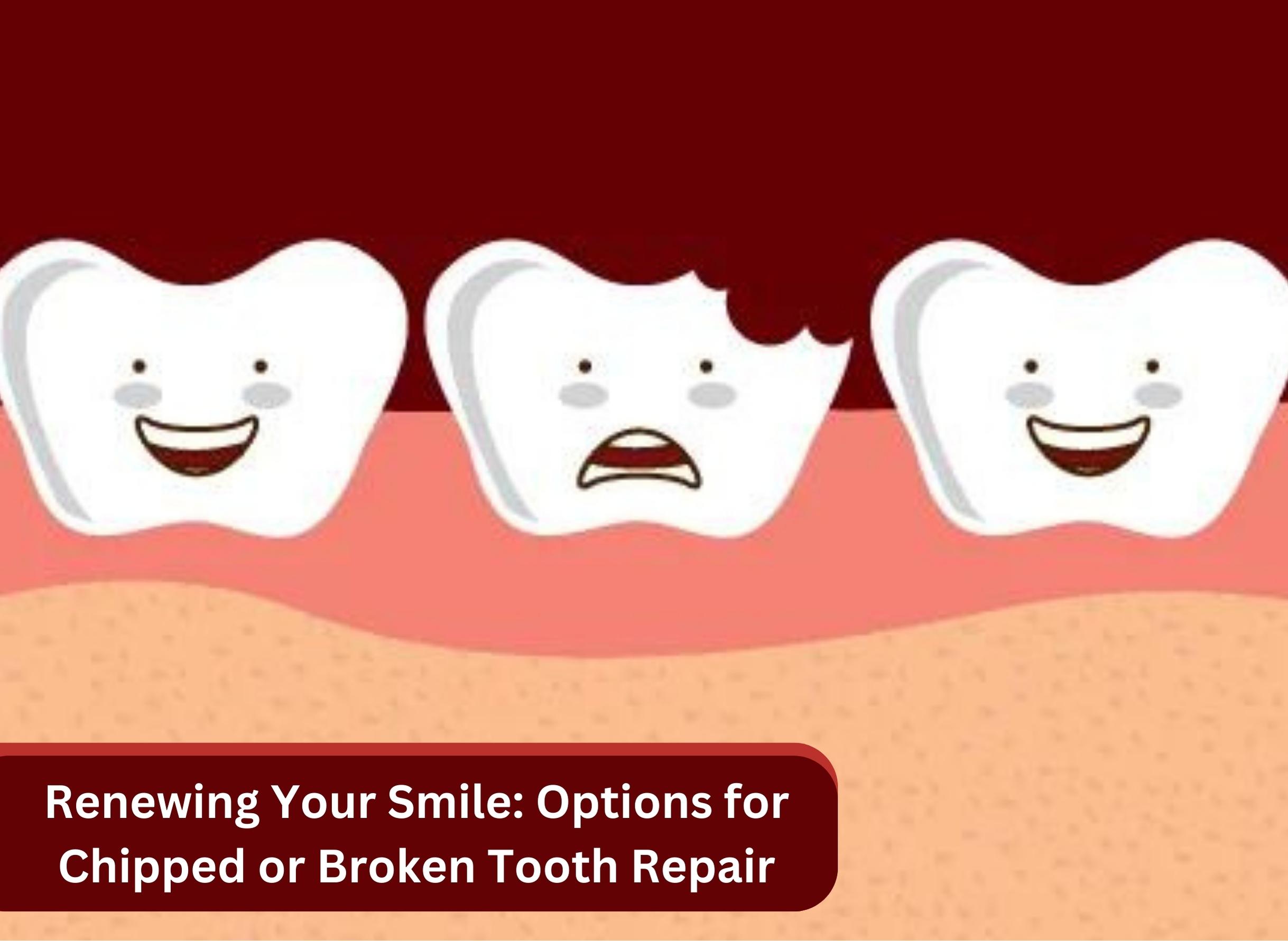 Renewing Your Smile: Options for Chipped or Broken Tooth Repair