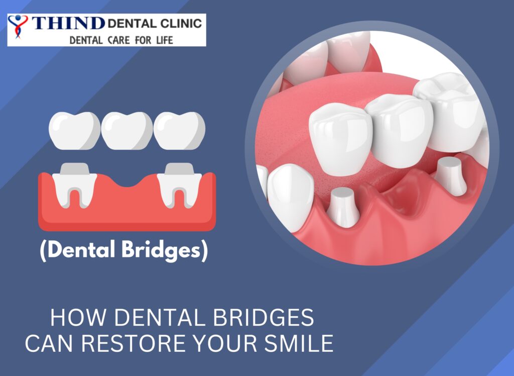 Dental Clinic in Ludhiana, Dental Clinic in jamalpur, Dentist in ludhiana, Dentist in jamalpur, dental care, general dentistry, Thind Dental Clinic in Ludhiana