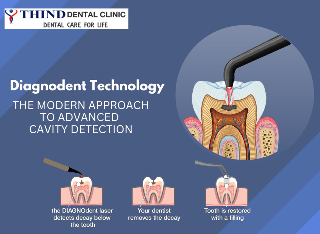 Dental Clinic in Ludhiana, Dental Clinic in jamalpur, Dentist in ludhiana, Dentist in jamalpur, dental care, general dentistry, Thind Dental Clinic in Ludhiana