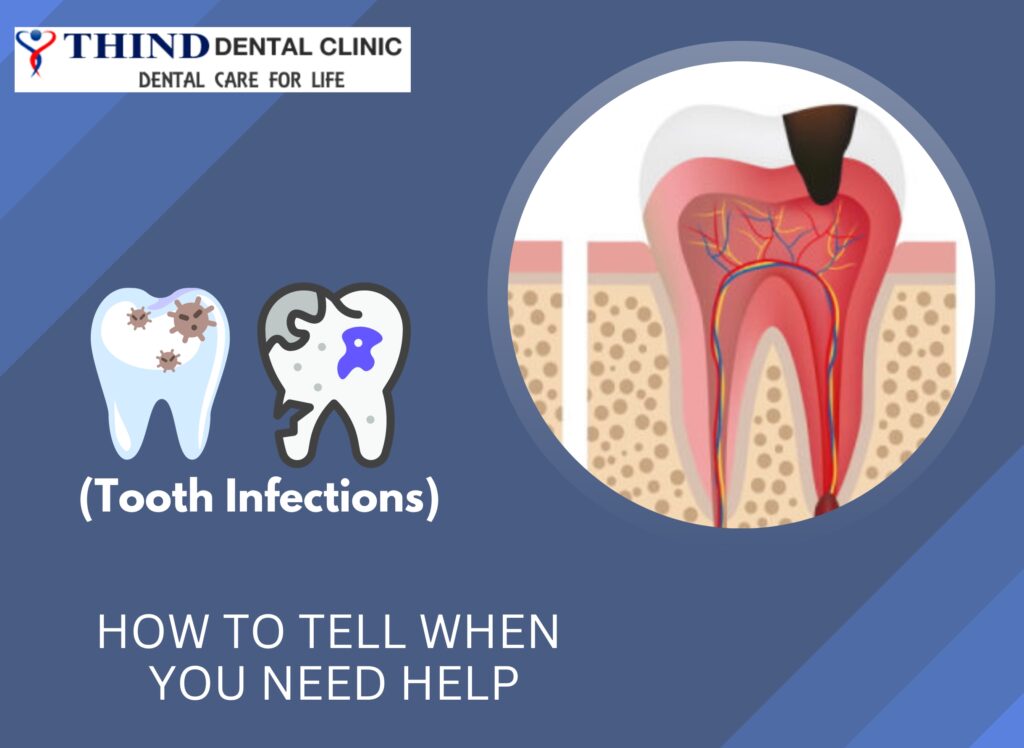 Dental Clinic in Ludhiana, Dental Clinic in jamalpur, Dentist in ludhiana, Dentist in jamalpur, dental care, general dentistry, Thind Dental Clinic in Ludhiana