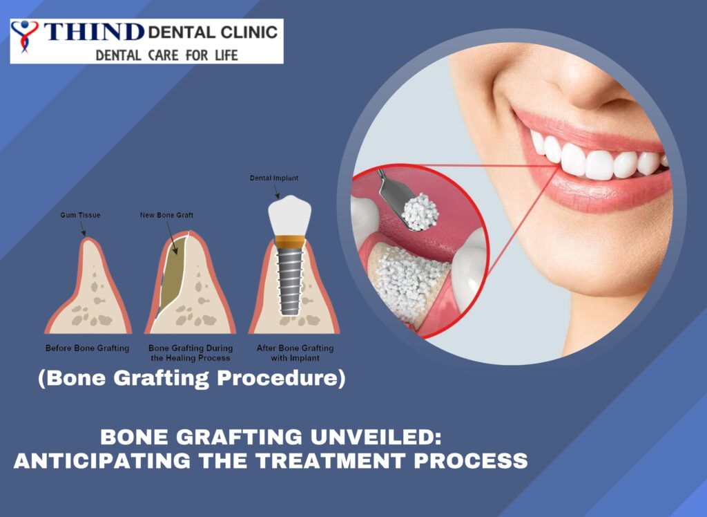 Dental Clinic in Ludhiana, Dental Clinic in jamalpur, Dentist in ludhiana, Dentist in jamalpur, dental care, general dentistry, Thind Dental Clinic in Ludhiana