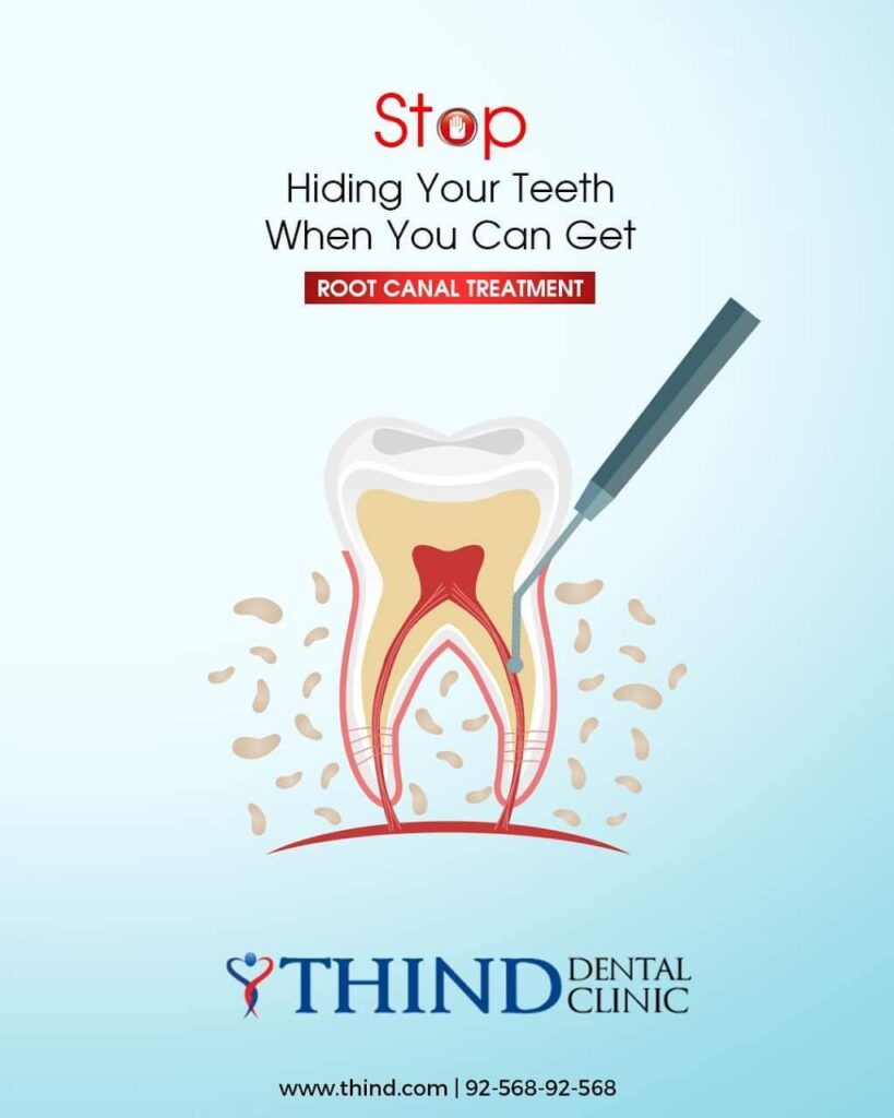 Dental Clinic in Ludhiana, Dental Clinic in jamalpur, Dentist in ludhiana, Dentist in jamalpur, dental care, general dentistry, Thind Dental Clinic in Ludhiana