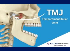 Understanding Temporomandibular Joint (TMJ) Disorders: Causes, Symptoms ...