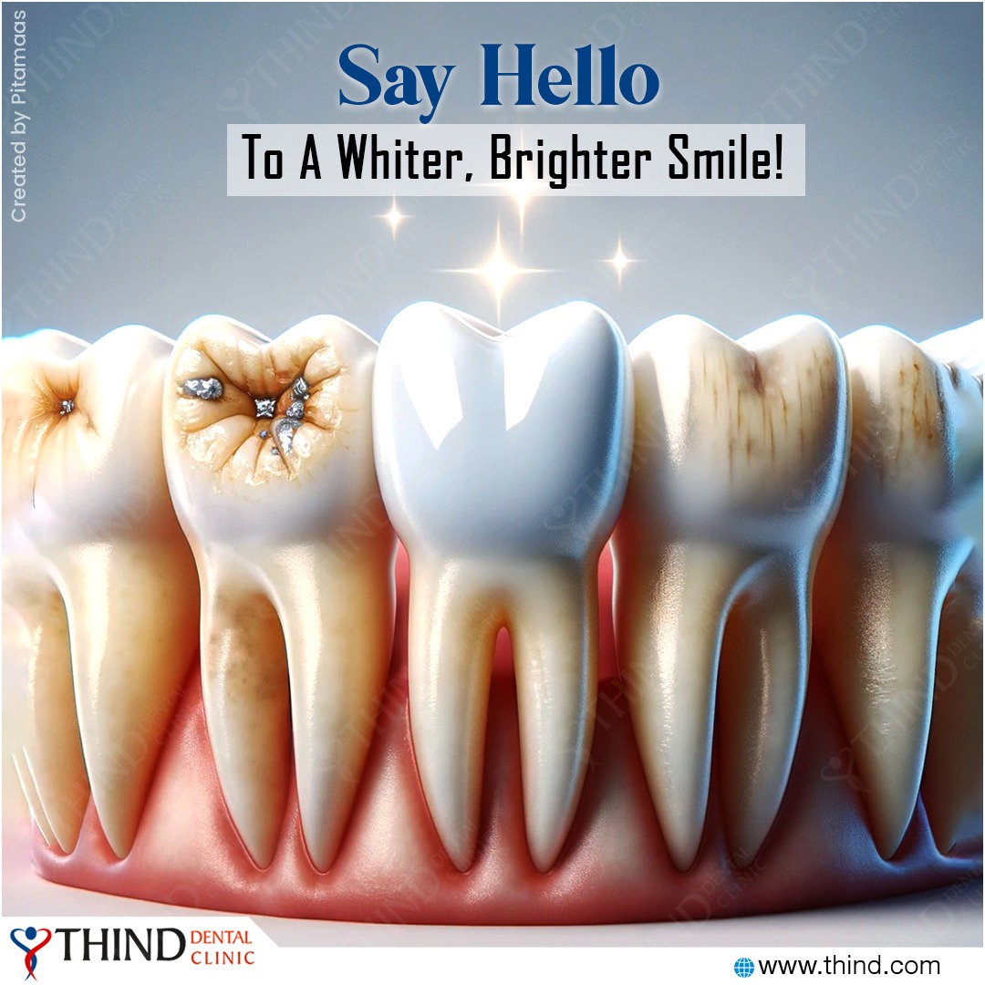 Subtle Smile Corrections: Enhance Your Smile Discreetly - Thind Dental  Clinic