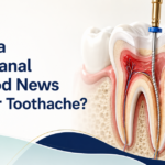 Why a Root Canal Might Be the Best News From a Toothache: What 2025-2026 Data Actually Shows