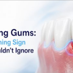 Bleeding Gums: The Warning Sign Nearly Half of Adults Are Ignoring