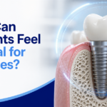 Why Dental Implants Placed Correctly Can Still Feel Natural Decades Later