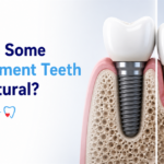 Why Do Some Replacement Teeth Feel Completely Natural While Others Never Do?