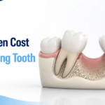 The Hidden Cost of a Missing Tooth: What It Does to Your Bite, Your Speech, and Your Jawbone