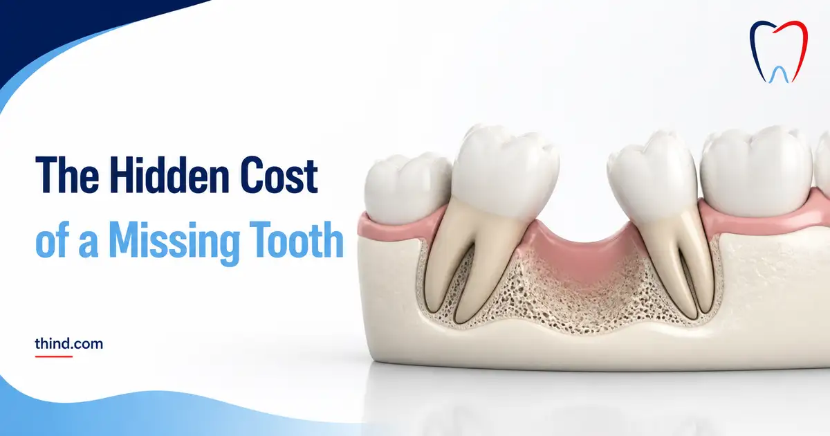 The Hidden Cost of a Missing Tooth: What It Does to Your Bite, Your Speech, and Your Jawbone