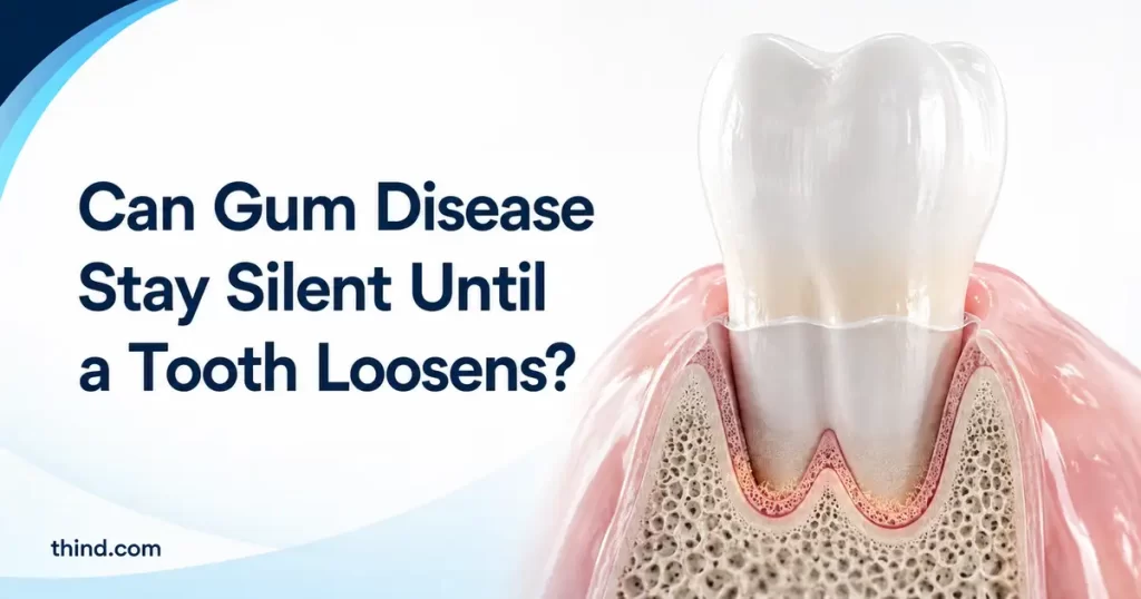 Why 51% of Indian Adults Already Have Gum Disease, and Most Feel Nothing Until a Tooth Loosens