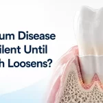 Why 51% of Indian Adults Already Have Gum Disease, and Most Feel Nothing Until a Tooth Loosens