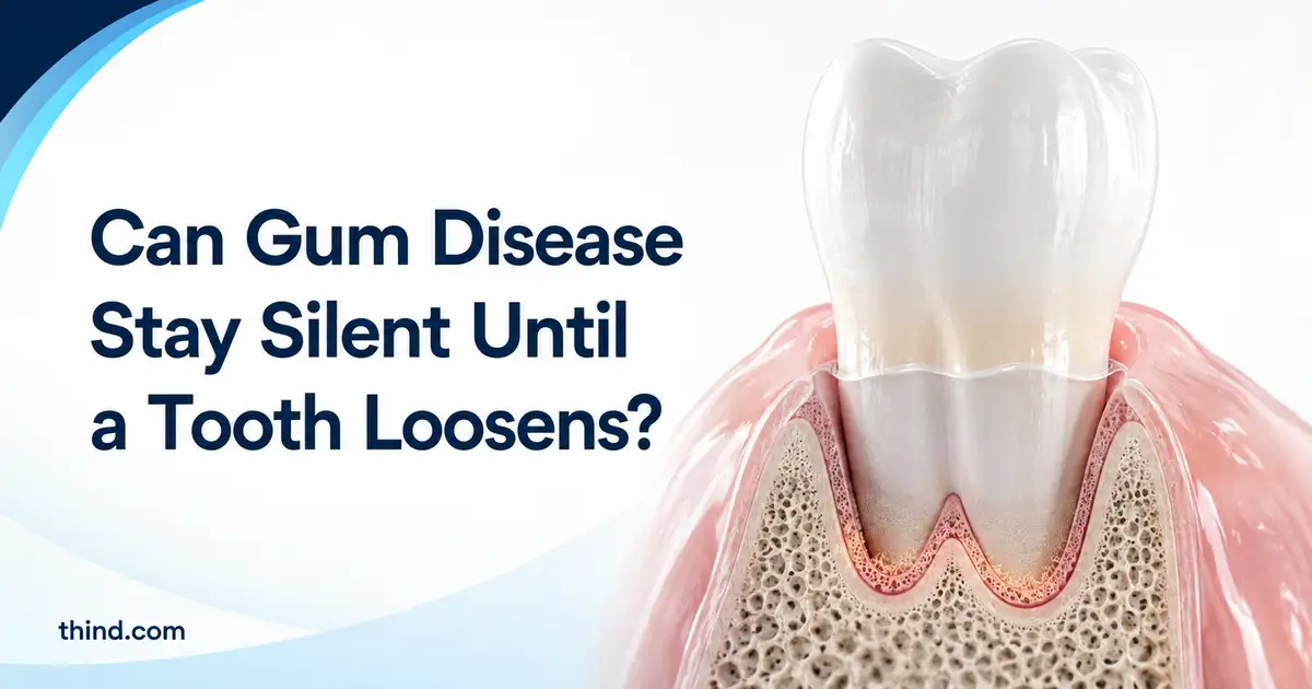 Why 51% of Indian Adults Already Have Gum Disease, and Most Feel Nothing Until a Tooth Loosens