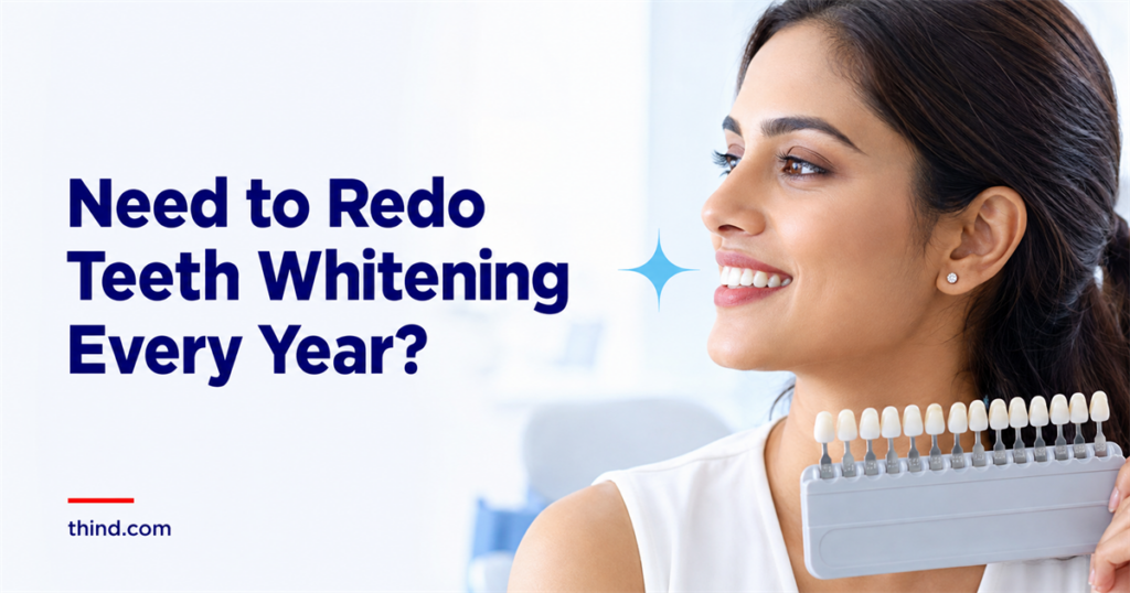 Do You Really Need to Redo Teeth Whitening Every Year? Here Is What Actually Happens to Your Results