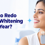 Do You Really Need to Redo Teeth Whitening Every Year? Here Is What Actually Happens to Your Results