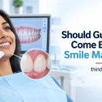 Why More Than 1 Billion People With Gum Disease May Be Planning Their Smile Makeover Backwards