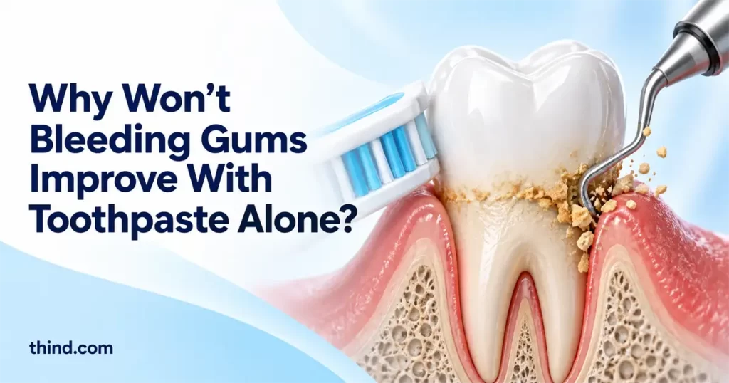 Why Bleeding Gums Rarely Get Better With Toothpaste Alone: What the Research Shows in 2026