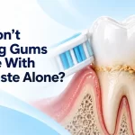 Why Bleeding Gums Rarely Get Better With Toothpaste Alone: What the Research Shows in 2026