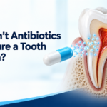 Why Antibiotics Alone Rarely Cure a Tooth Infection, According to 2026 Dental Research