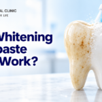 Does Whitening Toothpaste Really Work? What 14 Trials and 1,597 People Show