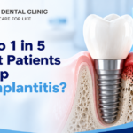 Why 1 in 5 Implant Patients Develops Peri-Implantitis, and How to Choose Implants That Last