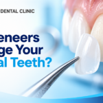 Will Veneers Damage Your Natural Teeth? What 25 Years of Clinical Data Shows