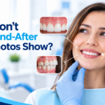 What Do Before-and-After Smile Photos Not Show? What Smile Research Says in 2026