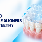 How Invisible Aligners Actually Work: What the Research Says About Moving Teeth Without Braces