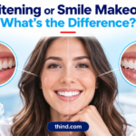 What Is the Difference Between Whitening and a Smile Makeover?