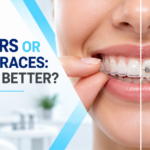 Are Aligners Better Than Metal Braces?
