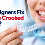 Can Aligners Fix Severe Crooked Teeth?